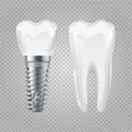 Dental implant. Realistic healthy tooth and implant. Vector dental surgery elements Royalty Free Stock Photo