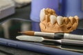 Dental implant. Restoration of teeth. Dental surgeon. Dental laboratory. Dental clinic. Implants of the jaw of a person. Visual