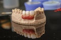 Dental implant. Restoration of teeth. Dental surgeon. Dental laboratory. Dental clinic. Implants of the jaw of a person. Visual