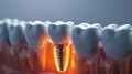 Dental implant, restoring smiles precision and durability, reliable solution for missing teeth, improving oral health Royalty Free Stock Photo