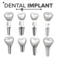 Dental Implant Set Vector. Dental Clinic Stomatology Flyer. Health Tooth Implant. Realistic Isolated Illustration Royalty Free Stock Photo