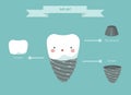 Dental implant structure, teeth and tooth concept of dental