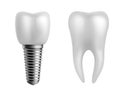 Dental implant and teeth. Realistic orthodontic elements. Human white enamel tooth crown, dentistry implantation Royalty Free Stock Photo