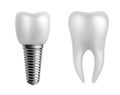 Dental implant and teeth. Realistic orthodontic elements. Human white enamel tooth crown, dentistry implantation technology, Royalty Free Stock Photo