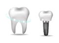 Dental implants, prosthetics 3D realistic style. Dentistry, healthy teeth concept. Vector illustration