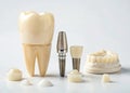 Dental implants and prosthetics with tooth model Royalty Free Stock Photo