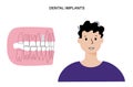 Dental implant procedure