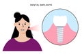 Dental implant procedure