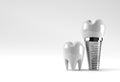 Dental Implants surgery concept 3D Rendering