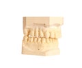 Dental impression 4