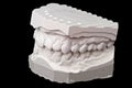 Dental impression chalk model Royalty Free Stock Photo