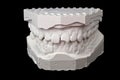 Dental impression chalk model Royalty Free Stock Photo