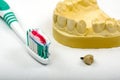 Dental Impression, Crown Implant, Toothbrush and toothpaste