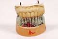 Dental Impressions Royalty Free Stock Photo