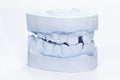 Dental impressions Royalty Free Stock Photo