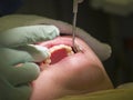 Dental Inspection