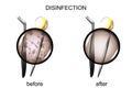 Dental instruments before and after sterilization