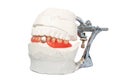 Dental Lab Articulator with dental prosthesis Royalty Free Stock Photo