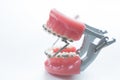 Dental lower jaw bracket braces model on white Royalty Free Stock Photo