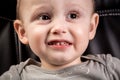 Dental medicine and healthcare - baby teeth with caries