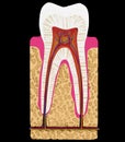 Dental medicine: Tooth cut or section isolated