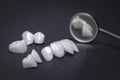 Dental mirror and zircon dentures on a dark background - Ceramic veneers - lumineers Royalty Free Stock Photo