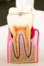 Dental model anatomy of the tooth cross-section dentist concept for education in laboratory medicine room