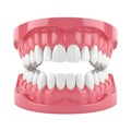 Dental model displaying teeth alignment Royalty Free Stock Photo