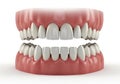 Dental model displaying teeth alignment Royalty Free Stock Photo