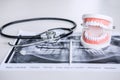 Dental model and equipment on tooth x-ray film and stethoscope u