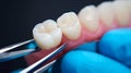 A dental model featuring a row of artificial teeth, with a focus on a molar being held Royalty Free Stock Photo