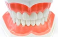 Dental Model of Teeth.