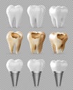 Dental model of a tooth, illustration as a concept of dental examination of teeth. Royalty Free Stock Photo