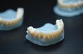 Dental models with artificial teeth sit on black surface. Jaw prosthetics show advanced 3D printing tech for modern dentistry. Royalty Free Stock Photo