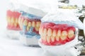 Dental models showing different types