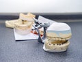 Dental molds for prosthetic teeth Royalty Free Stock Photo