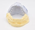 Dental Molds on White Background Royalty Free Stock Photo