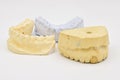 Dental Molds on White Background Royalty Free Stock Photo