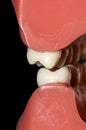 Dental occlusion molars teeth close up