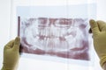 Dental panoramic x-ray of jaw close up