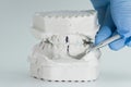Dental plaster bite model examined with tool Royalty Free Stock Photo
