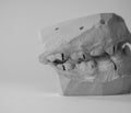 Dental plaster cast of teeth for the manufacture of orthodontic apparatus. Children\'s orthodontics
