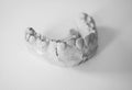 Dental plaster cast of teeth for the manufacture of orthodontic apparatus. Children\'s orthodontics