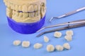 Dental plaster models in a dental clinic.Dental procedures concept.