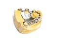 Dental plaster moulds, Dentures