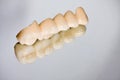 Dental porcelain bridge