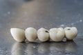 Dental porcelain bridge.