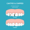 Dental poster. Dentistry and stomatology poster. Cavities and chipped Royalty Free Stock Photo