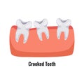 Dental Problem Poster Royalty Free Stock Photo