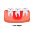 Dental Problem Poster Royalty Free Stock Photo
